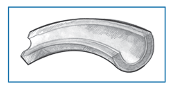 Drawing of a healthy blood vessel, showing no narrowing.